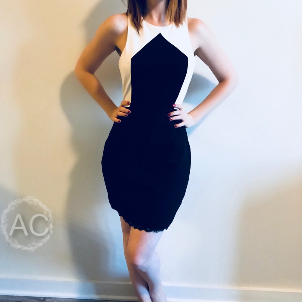 Trina Turk Black and White Dress Lace Trim